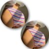 set-2